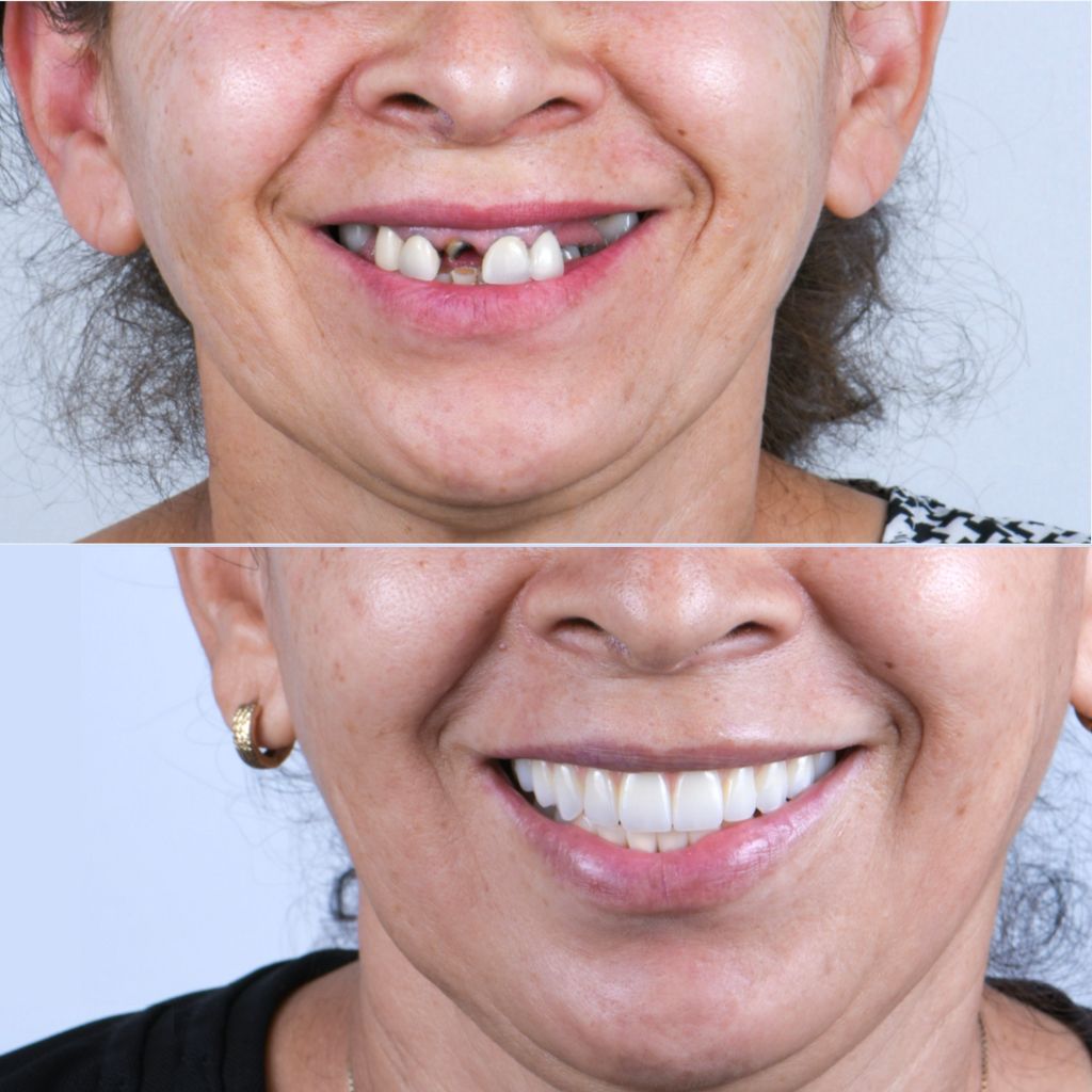 Ricardo López Lemus-130