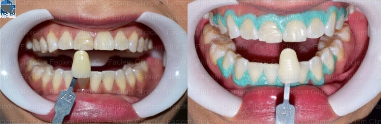 Ricardo Parra García-12