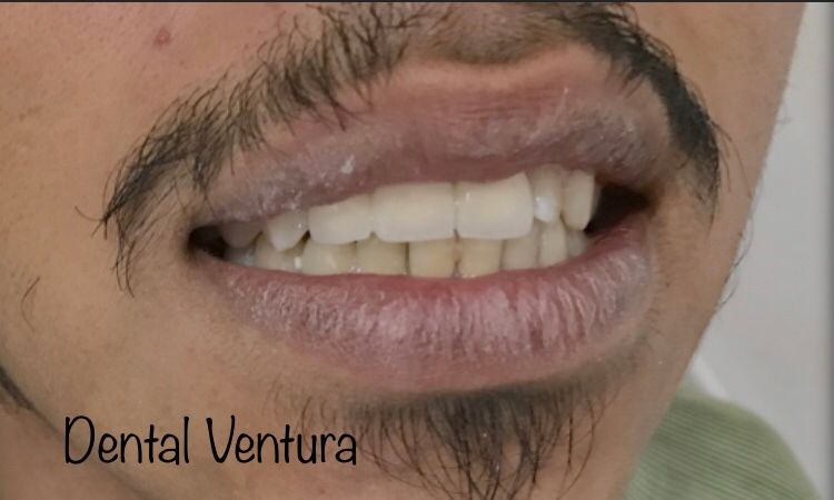 Antonio Cerda Ventura-20