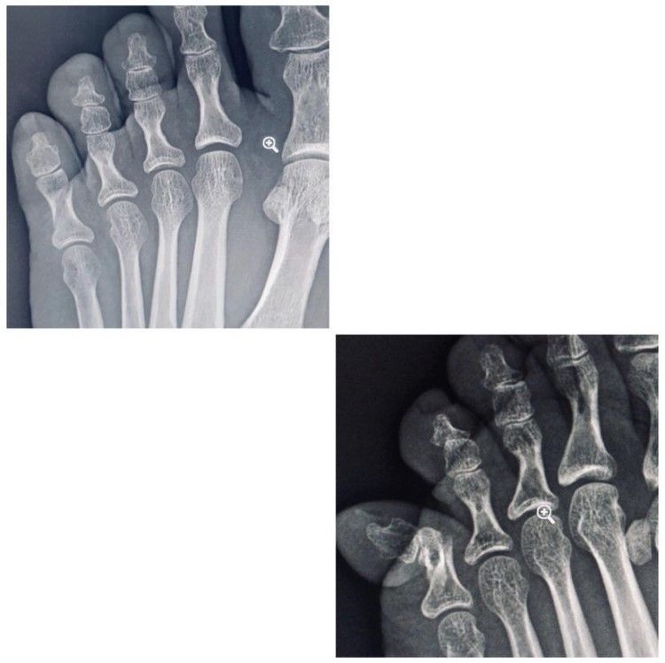 Gilberto Hernández Ortega-44