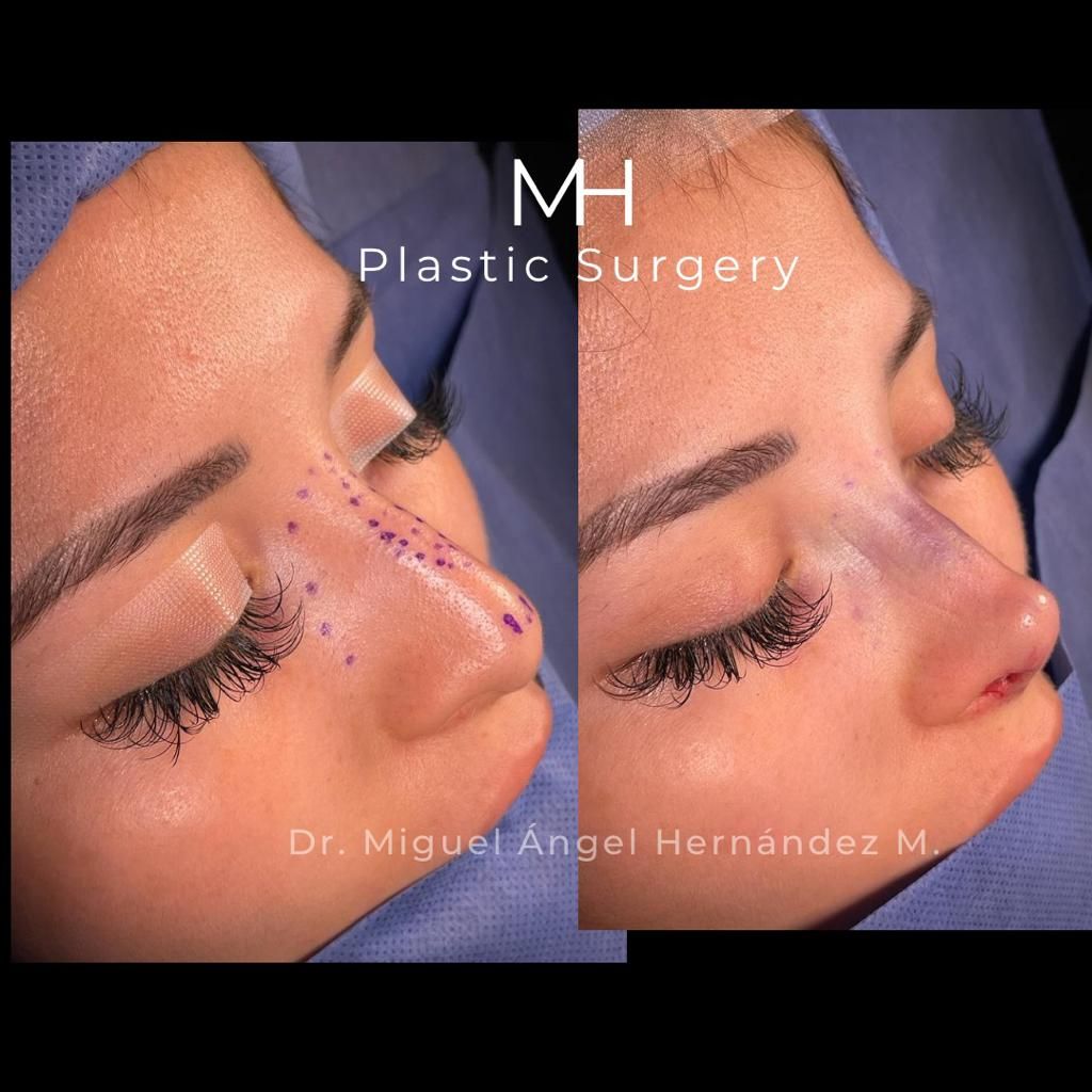 Miguel Angel Hernández Muñoz-1