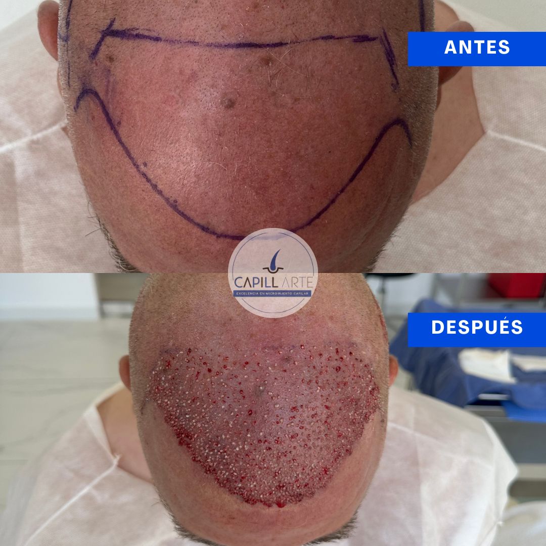 Adrian Hernandez Lopez-36