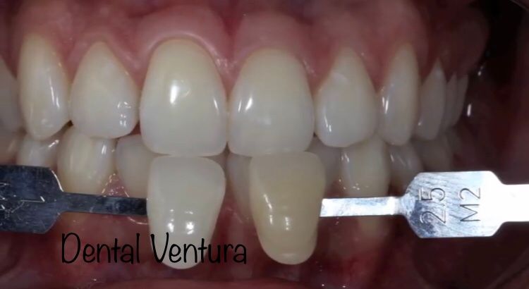 Antonio Cerda Ventura-24