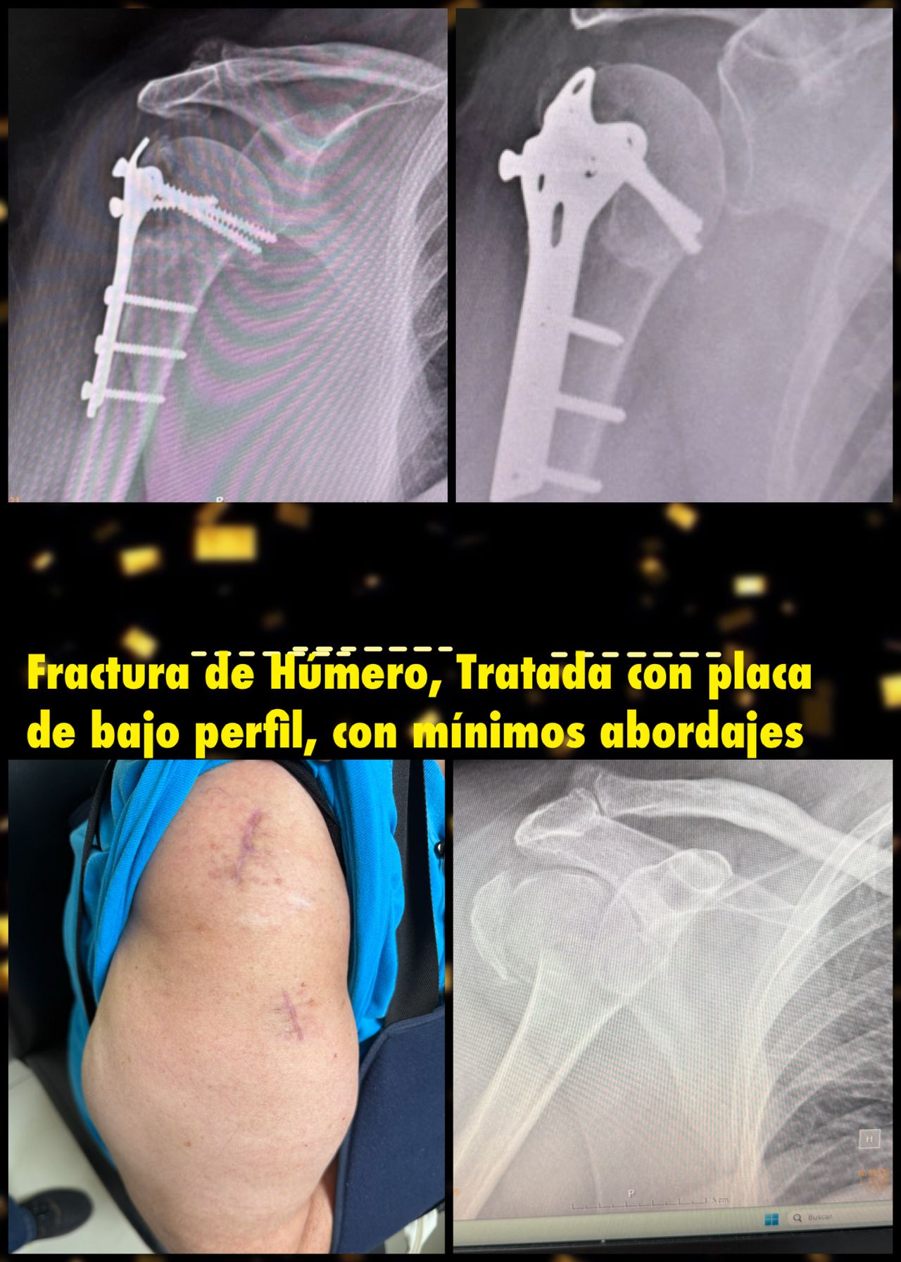 Carlos Tapia Hernández-14