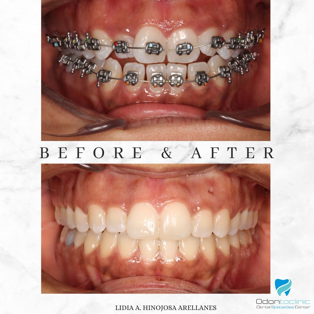 Lidia Abigail Hinojosa Arellanes-34