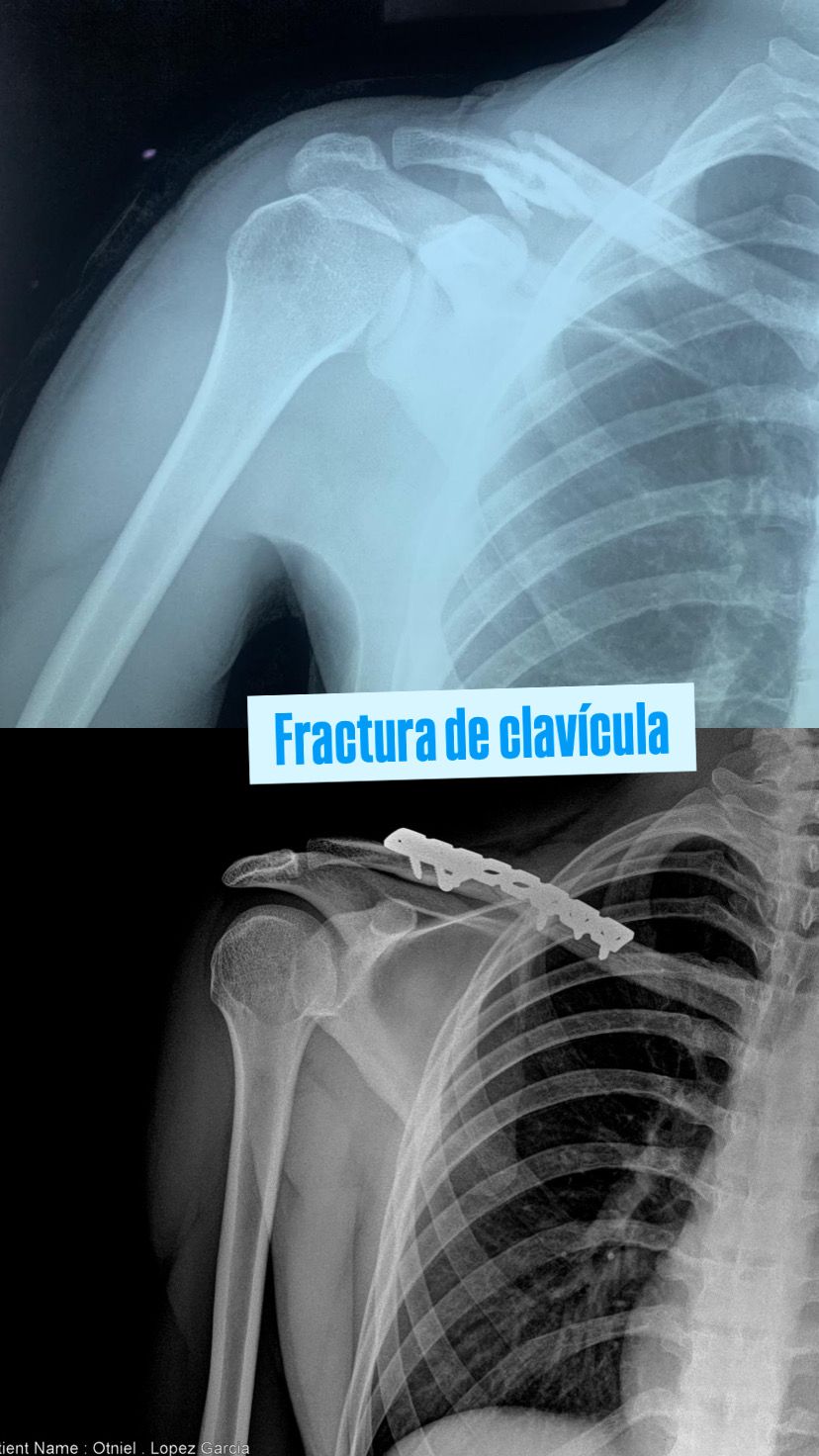 Juan Pablo Torres Nilo-4