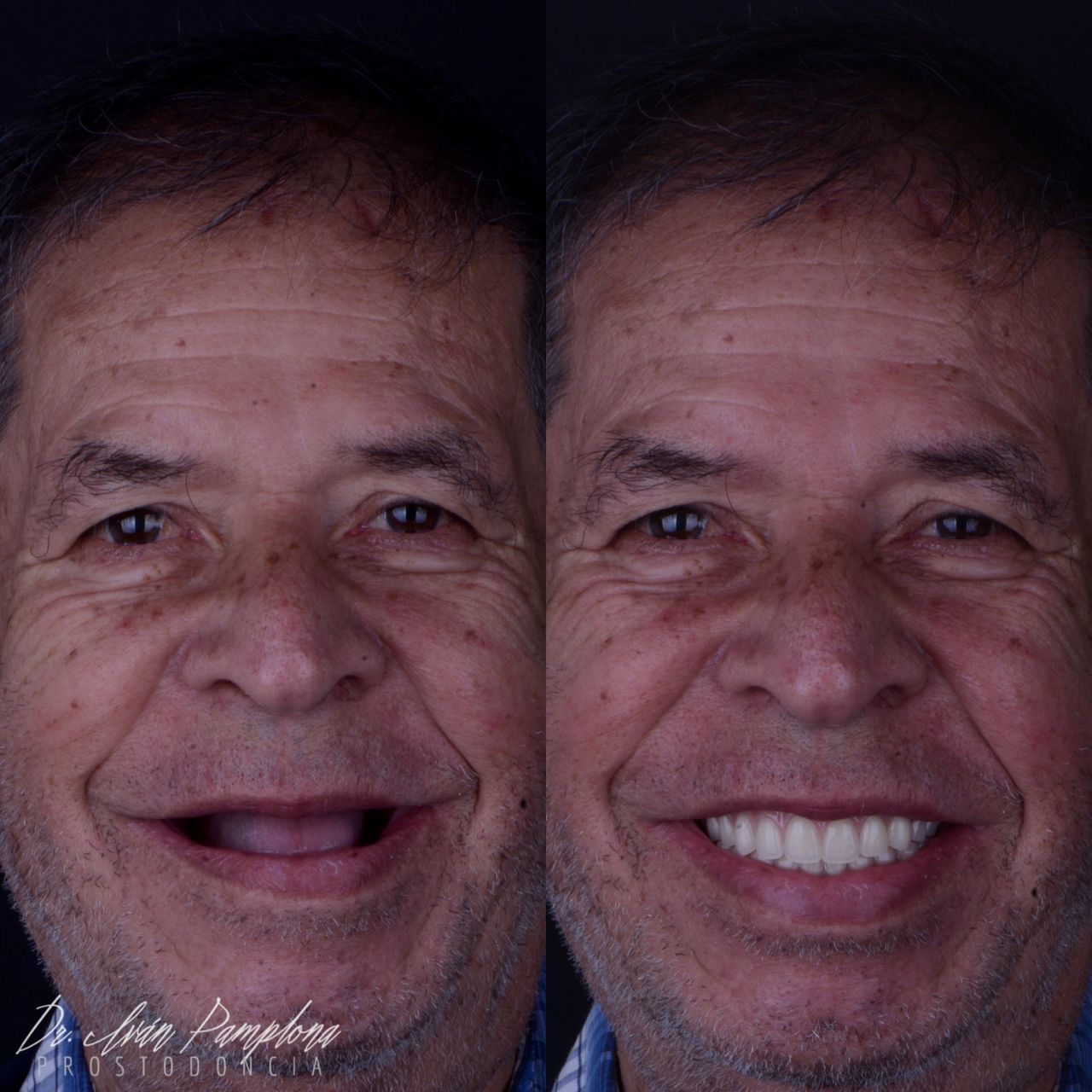 Iván Gerardo Pamplona Alfaro-20