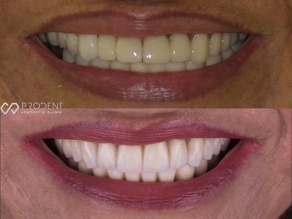 Ulises Pérez Murillo-35