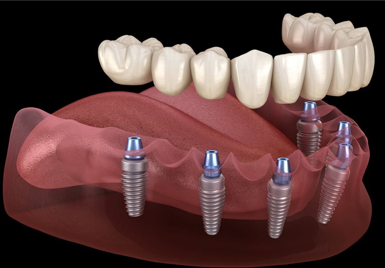 Neguib Villavicencio Raful-33