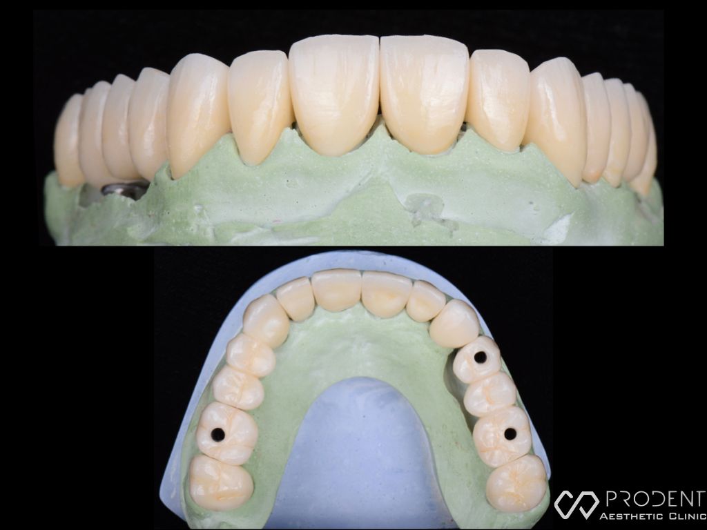 Ramiro Ivan Pérez Murillo-50