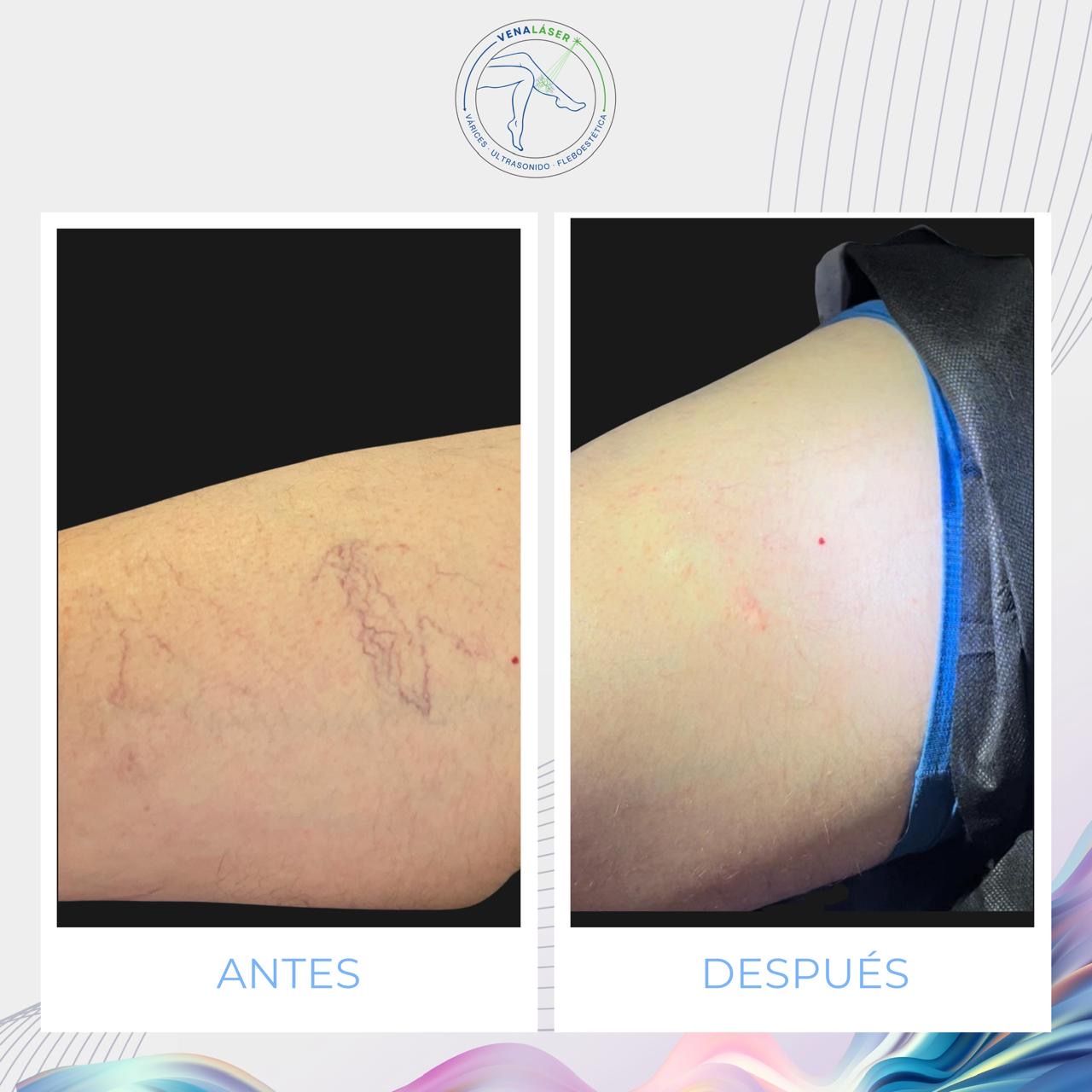 Mishell Eduardo Santander Becerra-14