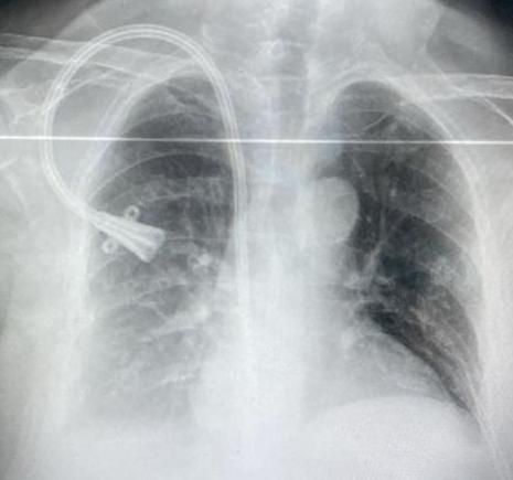 Isis Alejandro Velázquez Ramirez-1