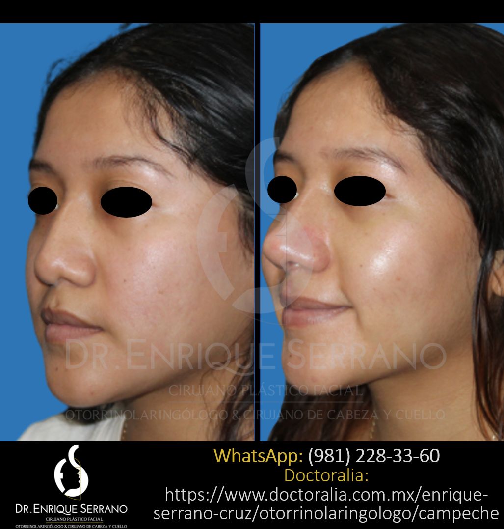 Enrique Serrano Cruz-45