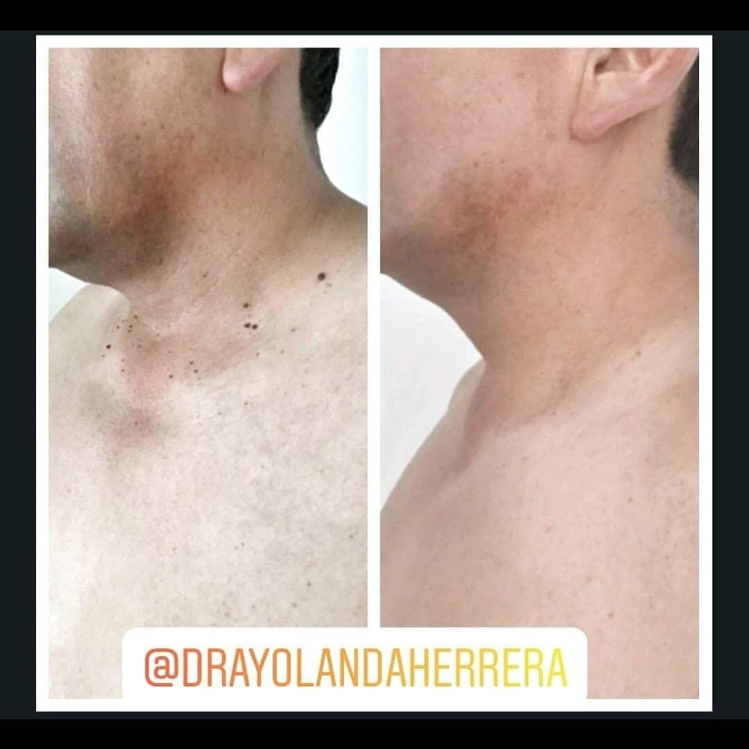 Yolanda Herrera Pablo-4