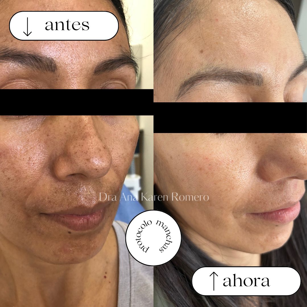 Ana Karen Romero Guzmán-2