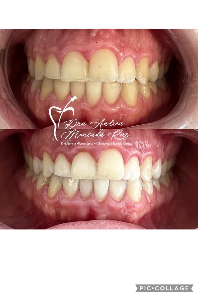 Andrea Moncada Rmz-9