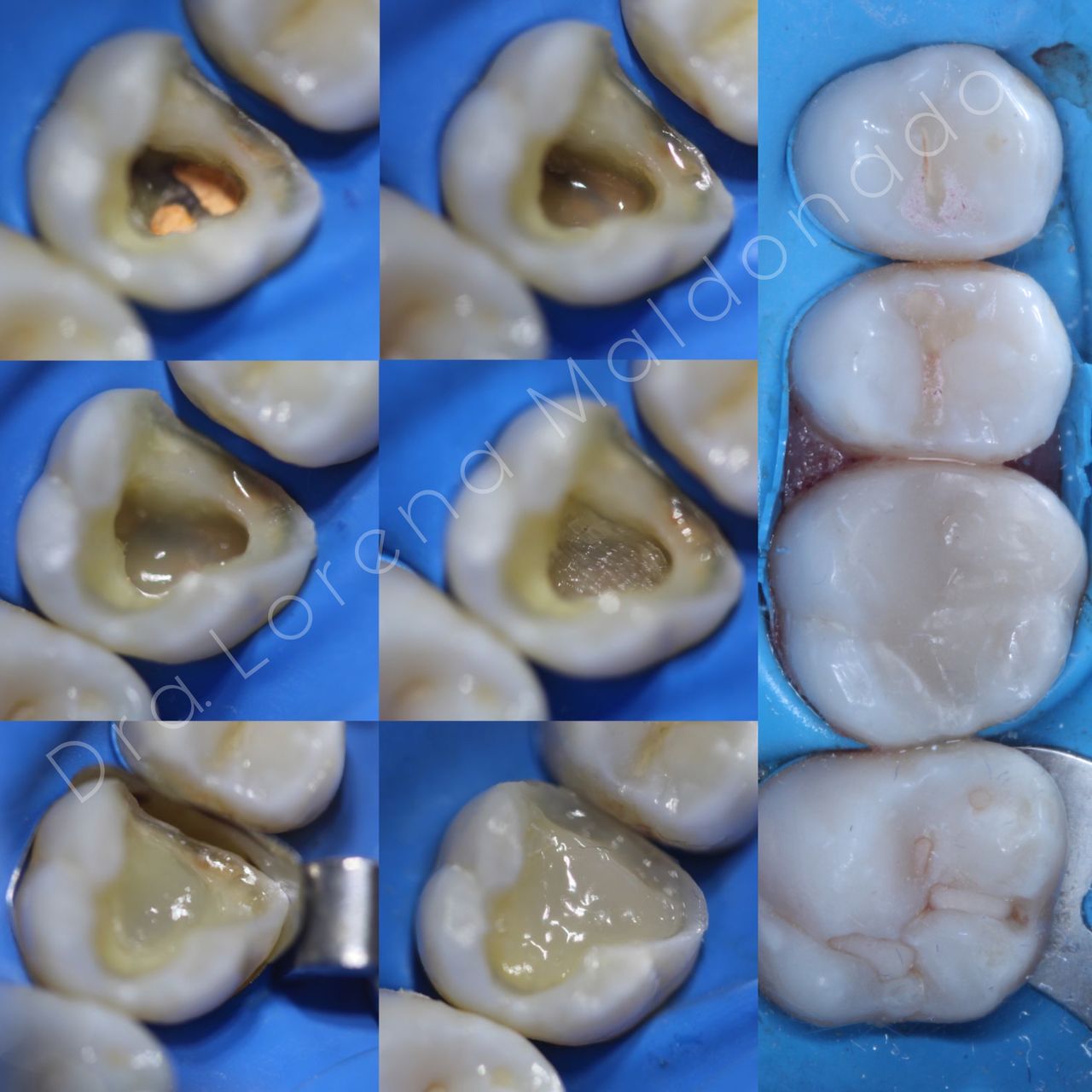 Ana Lorena Maldonado Munguia-13