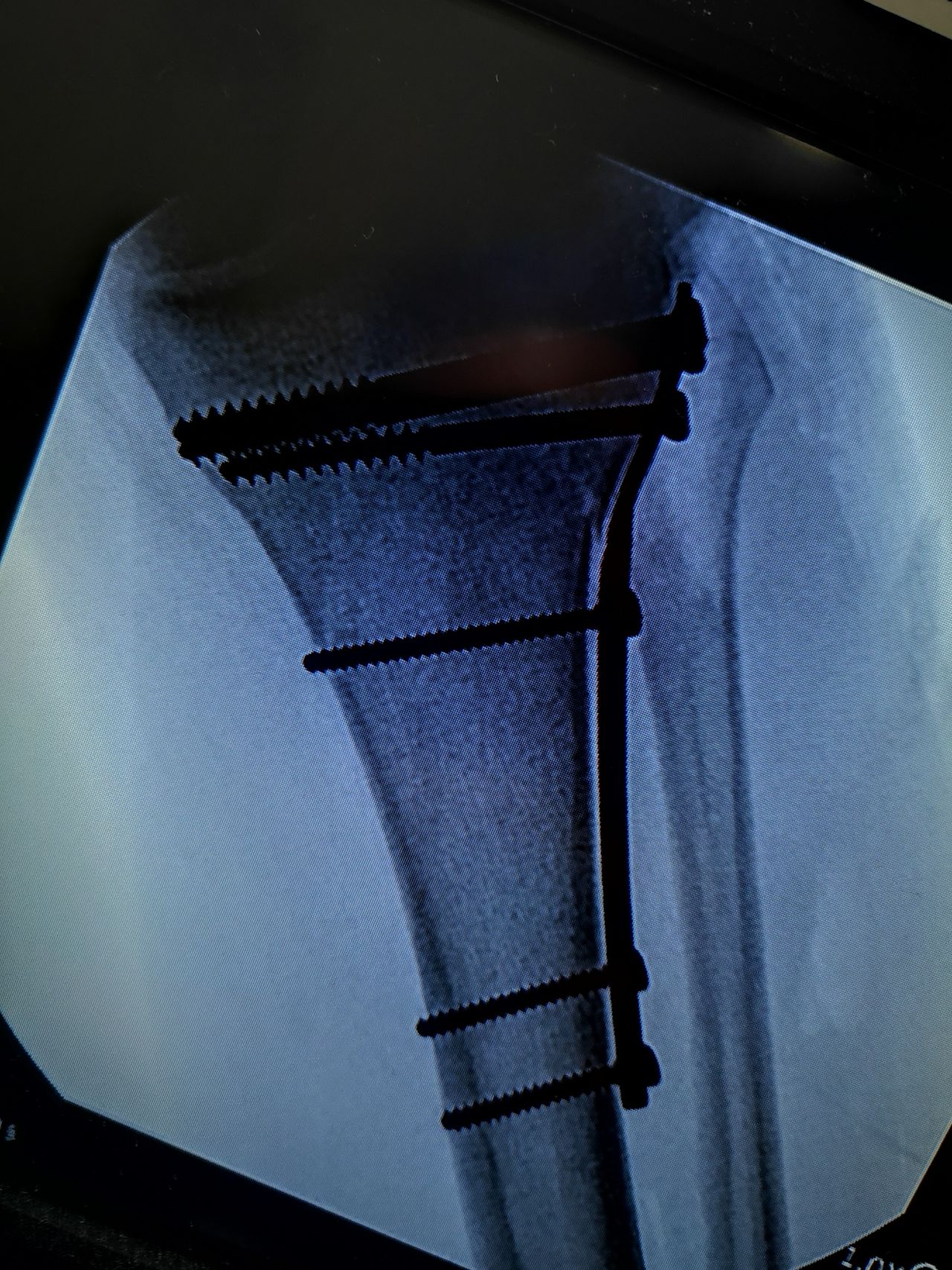 Manuel Ernesto Palma Palma-3