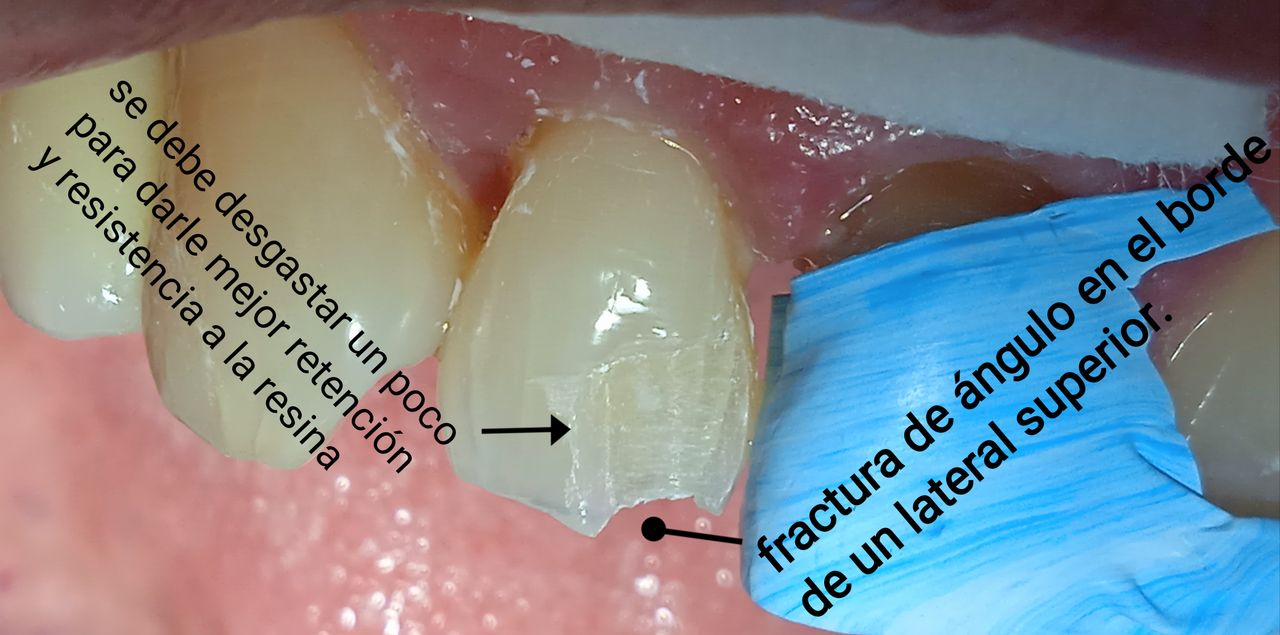Jessica De La Barrera Valladolid-28