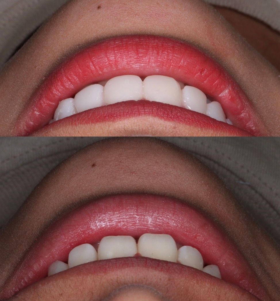 Francisco Galeana Araujo-0