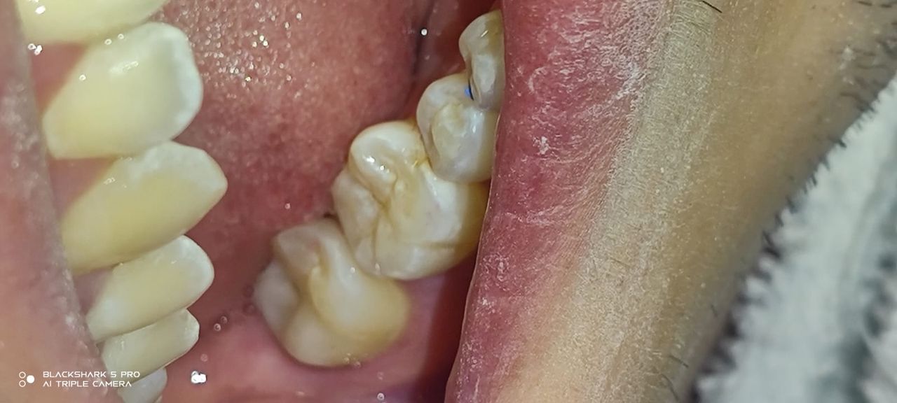 Jonathan Manuel Morán Castell-46