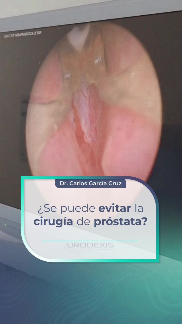 Carlos García Cruz-31