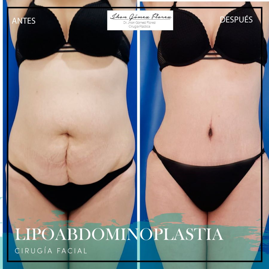 Jhon César Gómez Florez-53