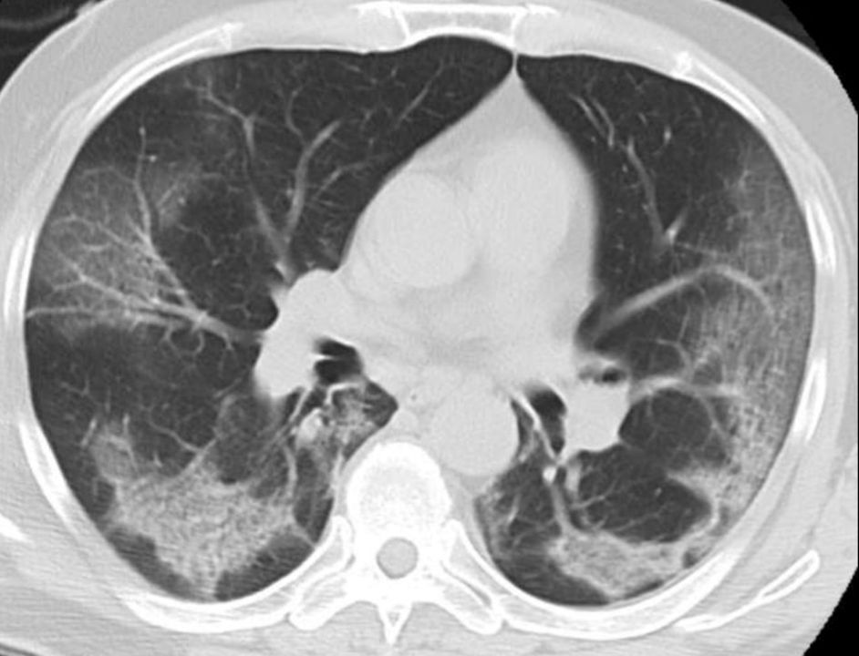 Adrian Estrada Campos-3