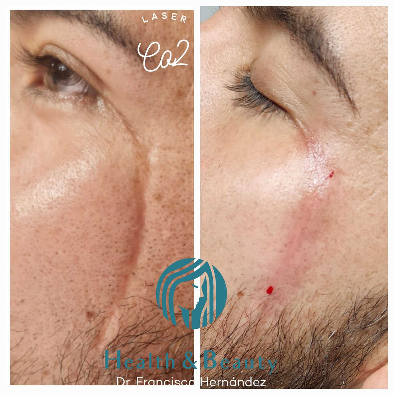 Francisco Hernández Gómez Crespo-31