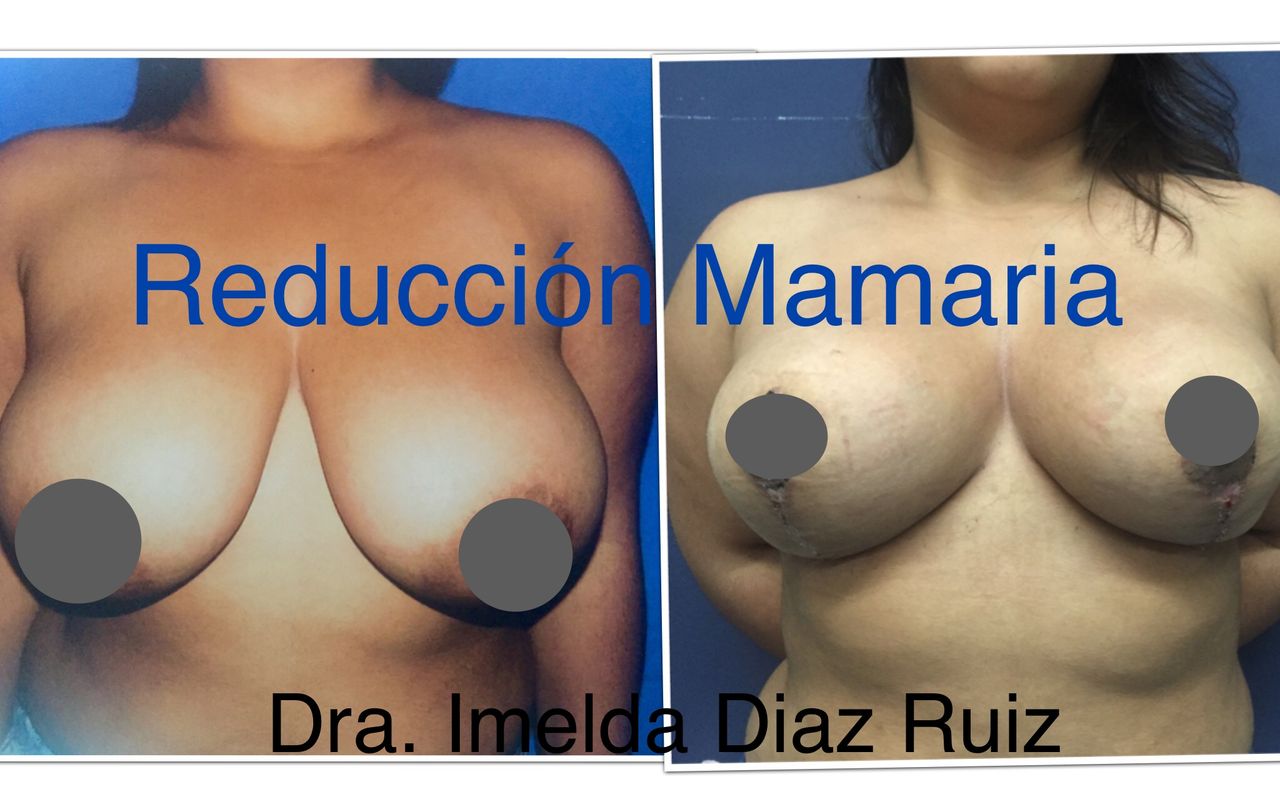 Imelda Díaz Ruiz-14