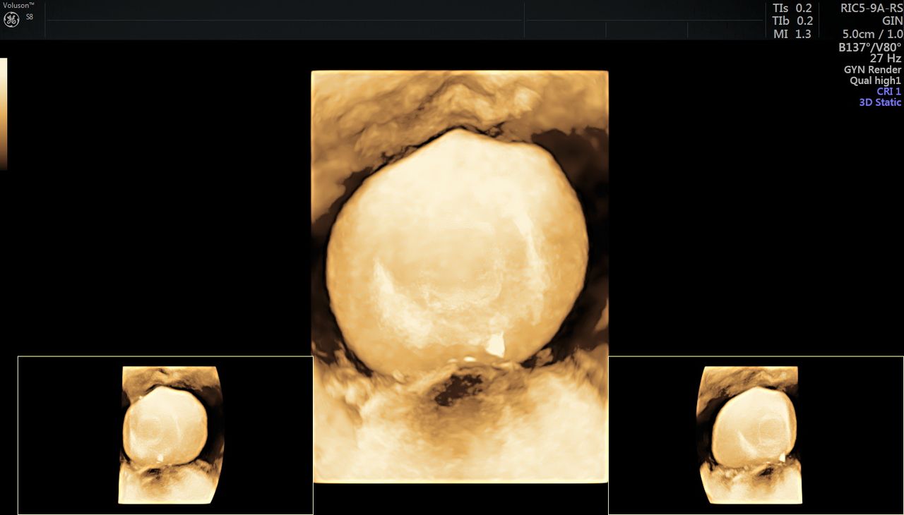 Griselda Reyes Torres-77