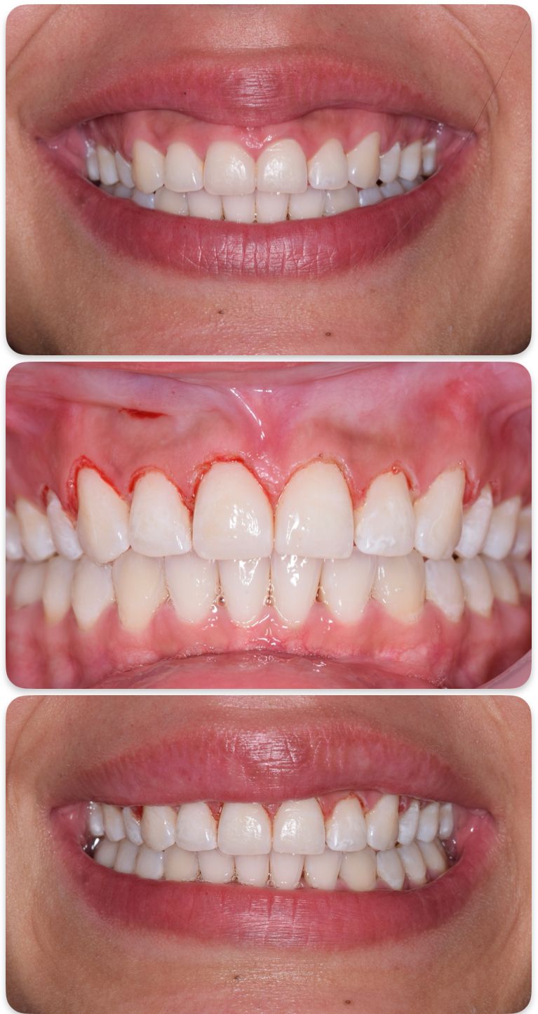 Adair Natanael Alvarez Castañeda-17