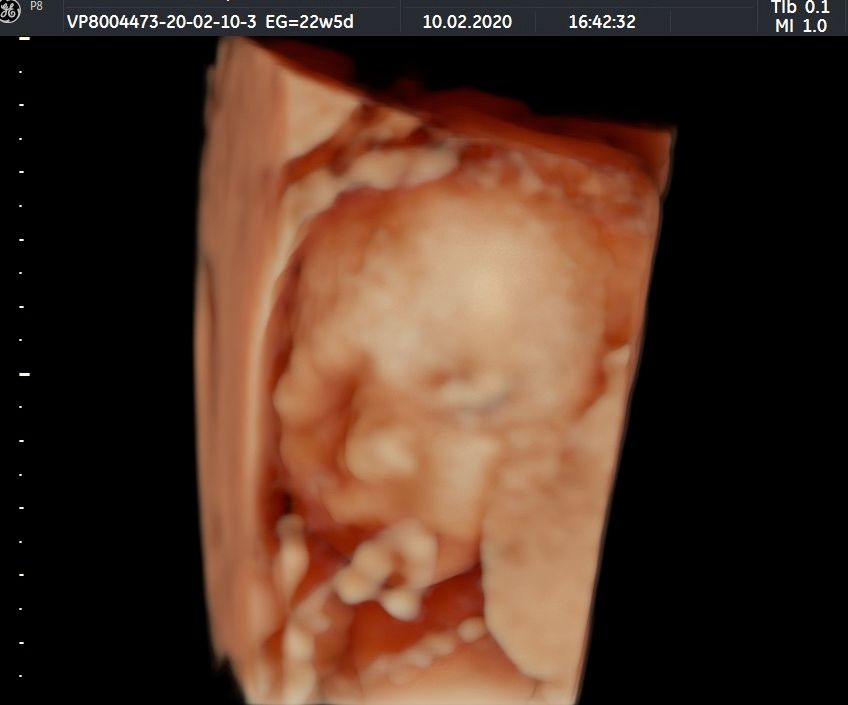 Susele Lara Rodríguez-0