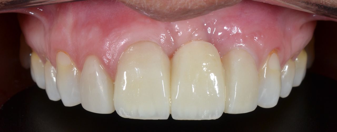 Francisco Jose Vives Serrano-30