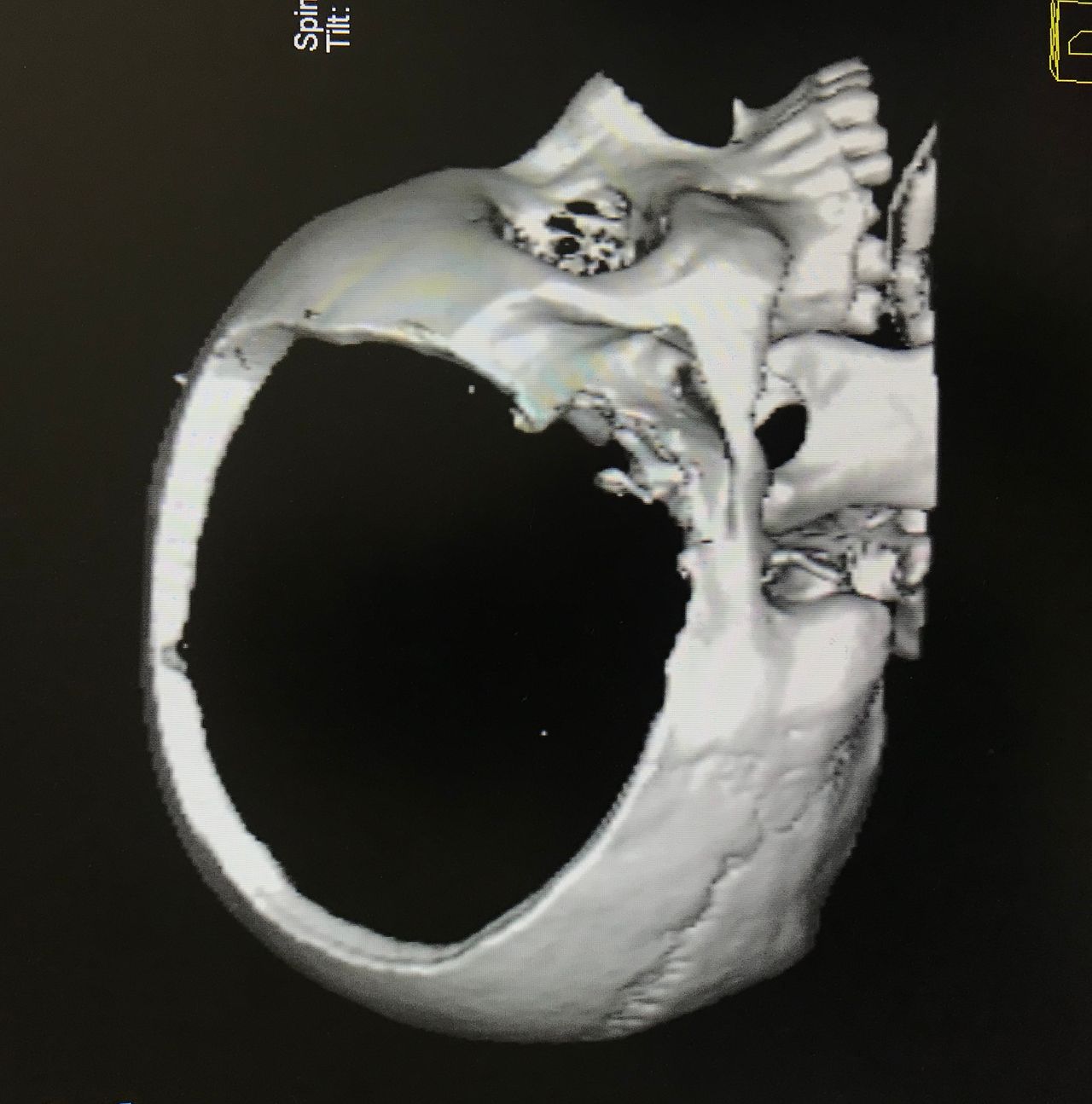 Rafael Maciel Morfin-48