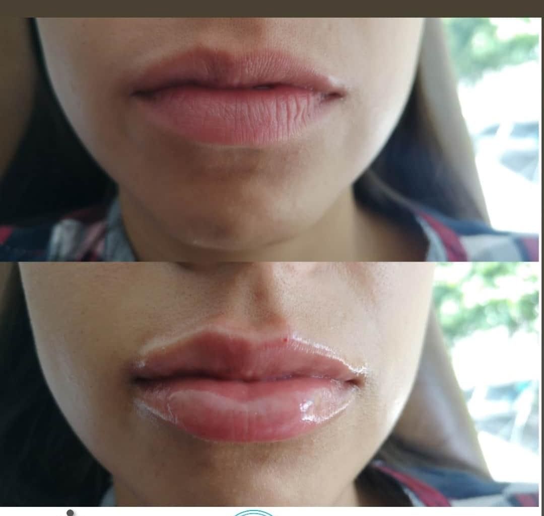 Gilliar Emmanuel Eudave De Lima-2