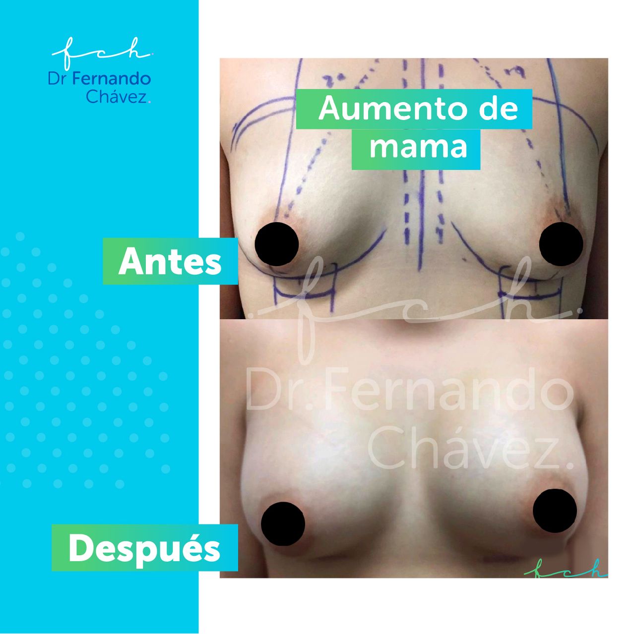 Fernando Chávez Osorio-22