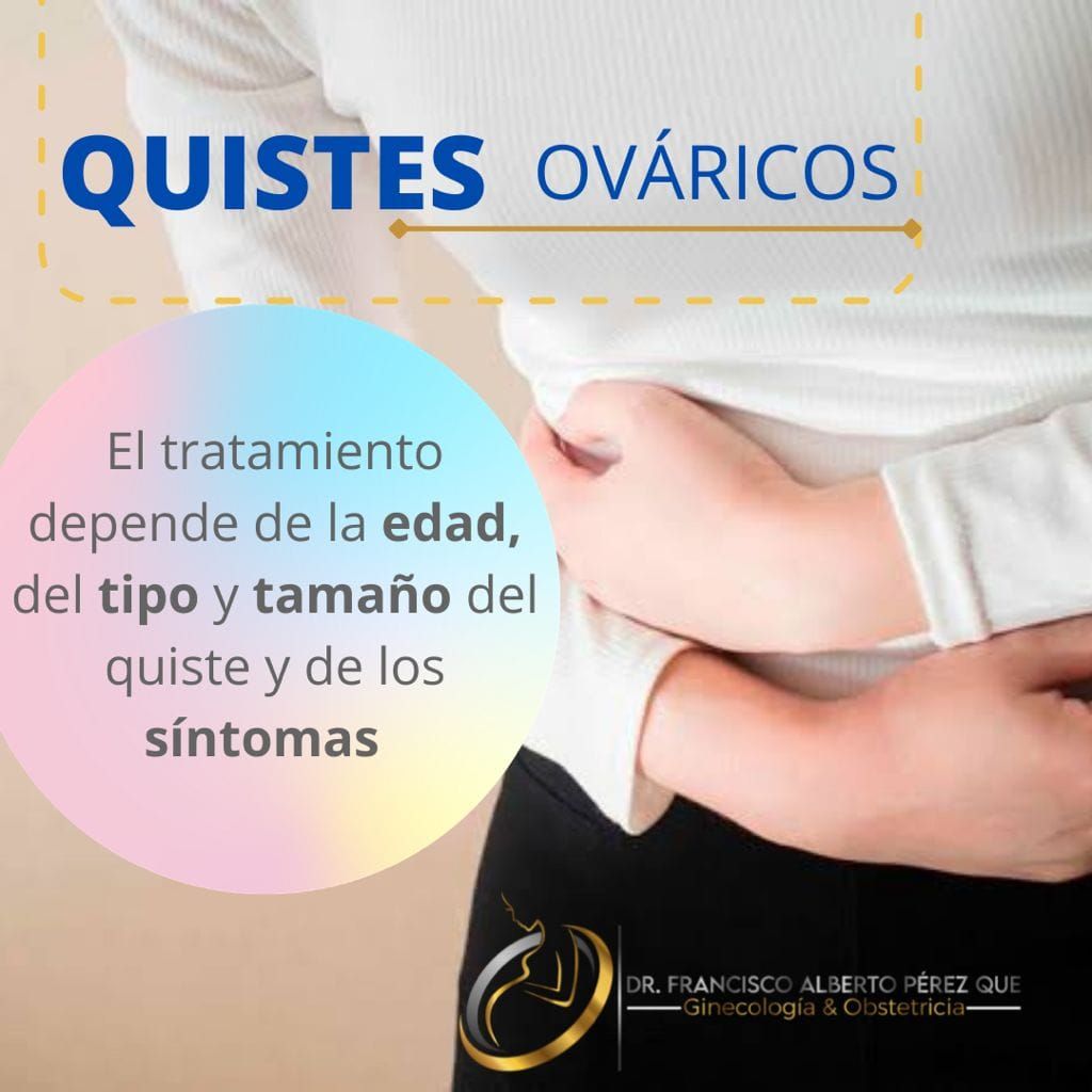 Francisco Alberto Perez Que-5