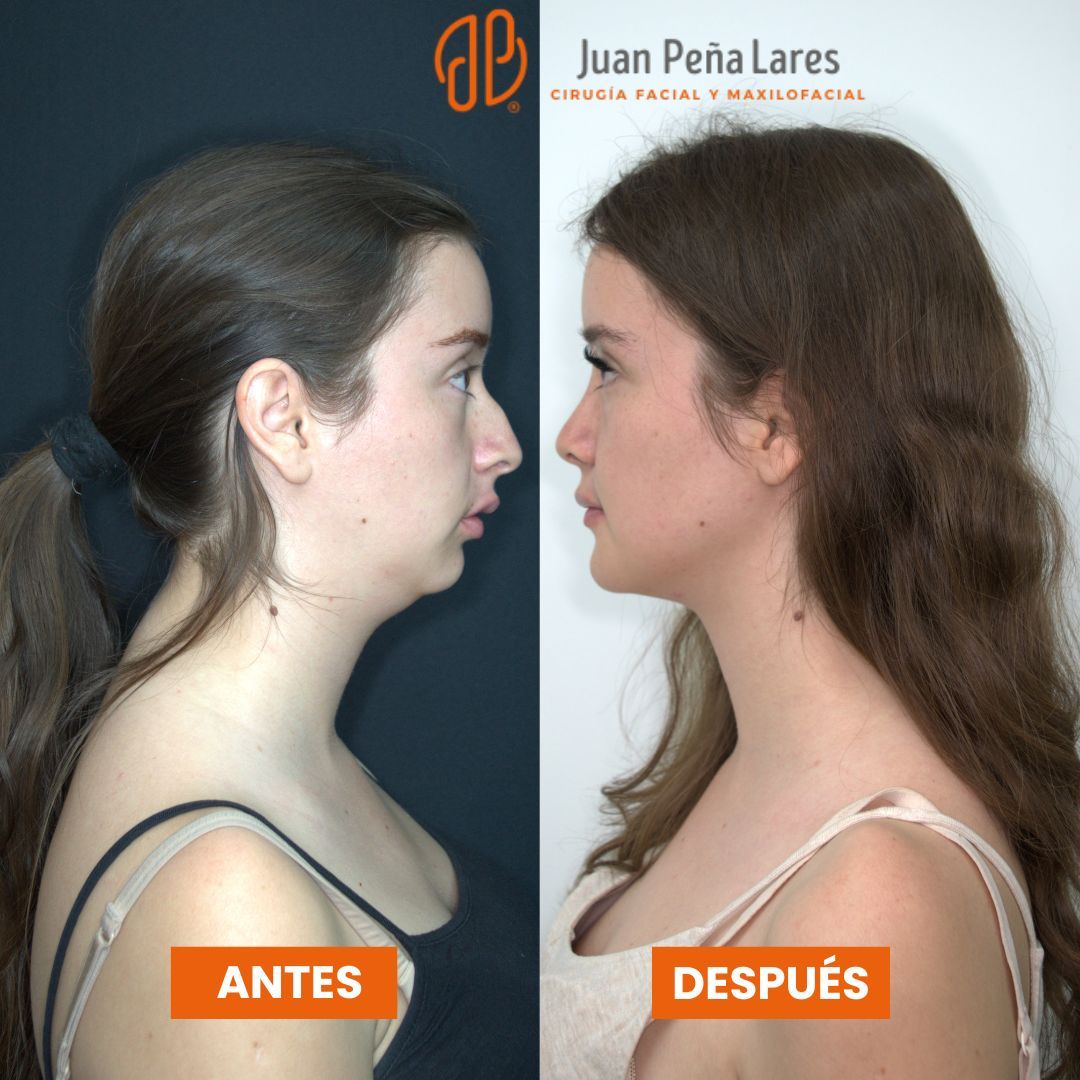 Juan Peña Lares-11