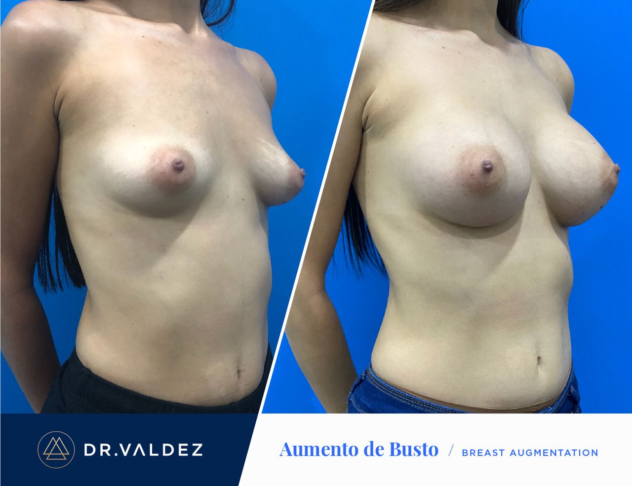 Pedro Arturo Valdez Gomez-29