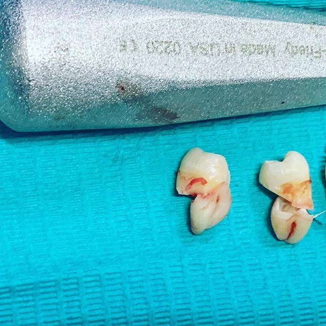 Alejandro Angelo López Díaz-11