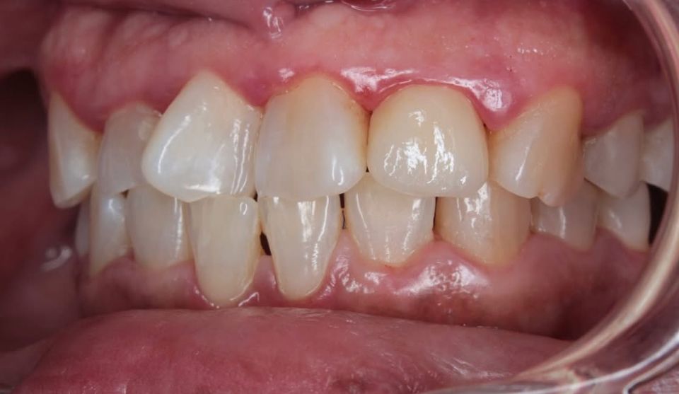 Carlos Enrique Hernández Rodríguez-19