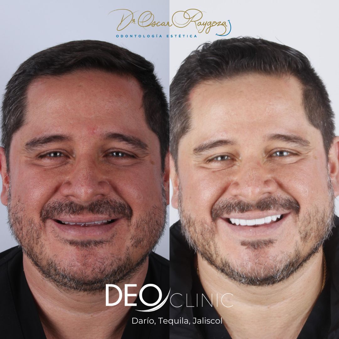 Oscar Raygoza Carrillo-24