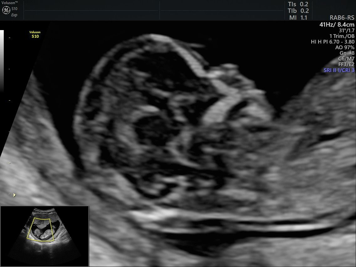 Martín Francisco Pérez Peña-3