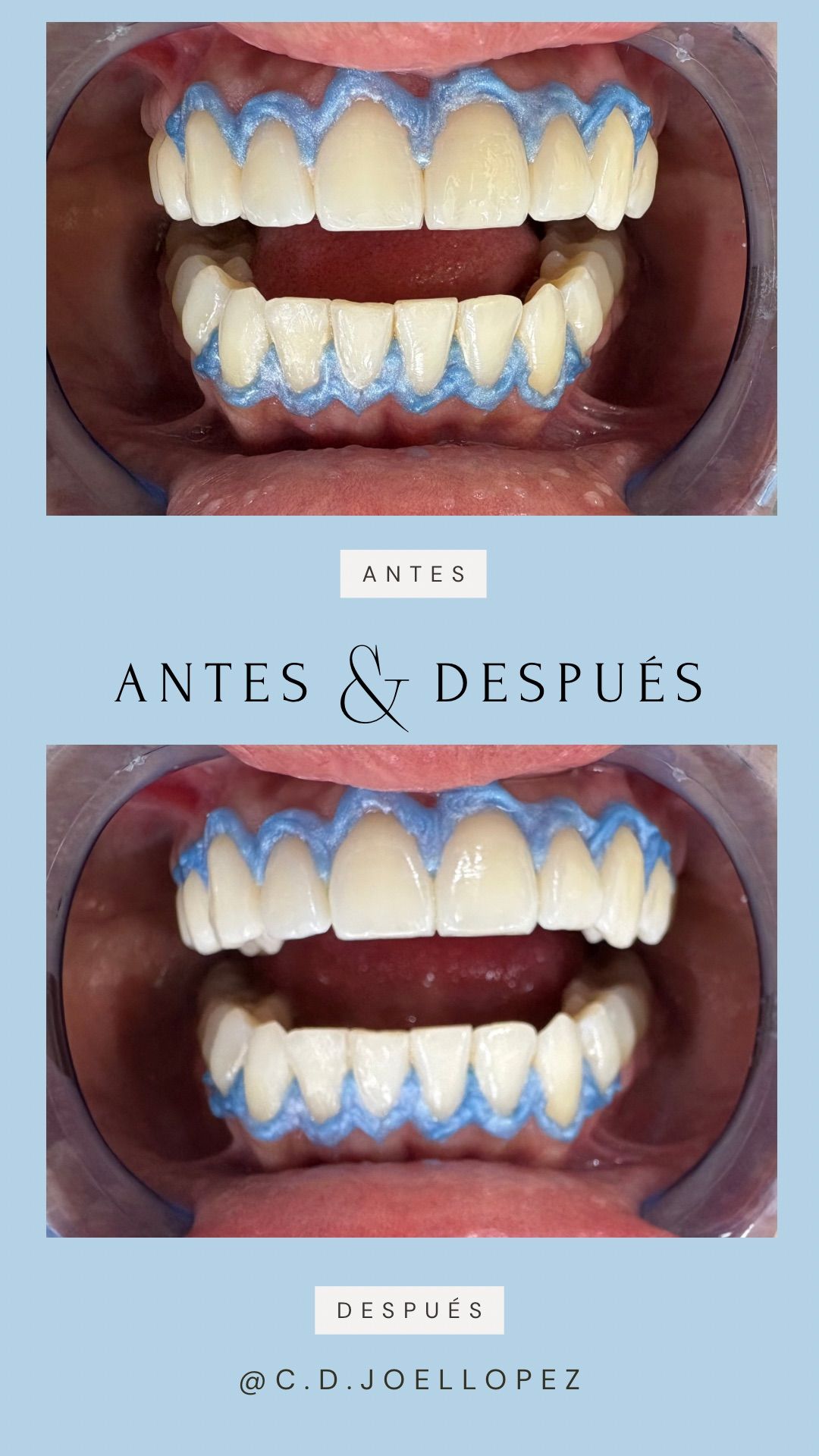 Joel Eduardo Lopez Molina-0