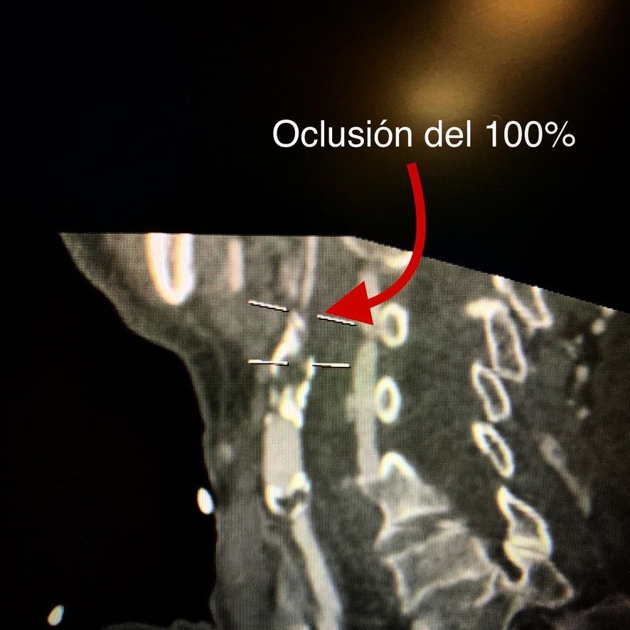 Juan René Cornejo Avendaño-9