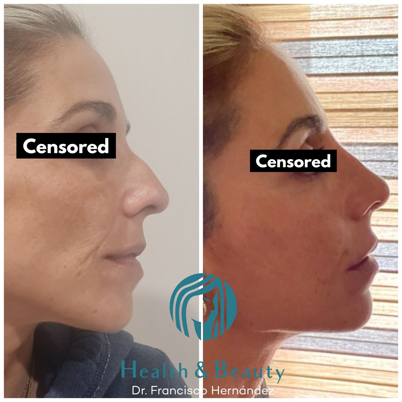 Francisco Hernández Gómez Crespo-95