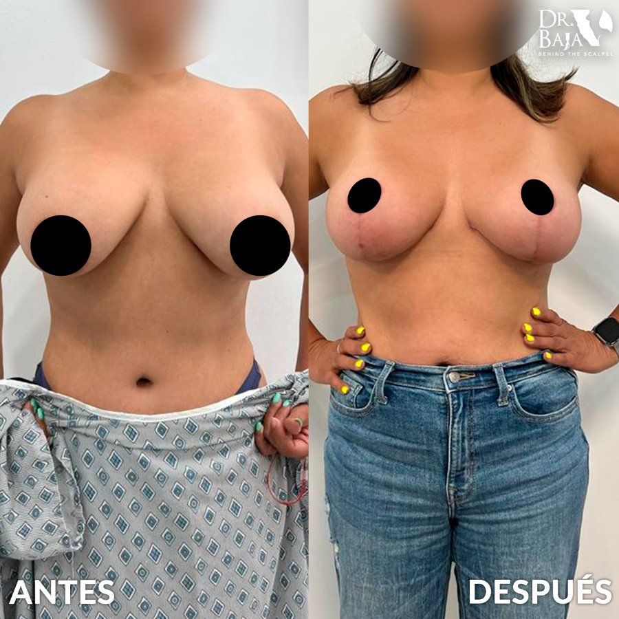 Renato Rodríguez Hirales-47