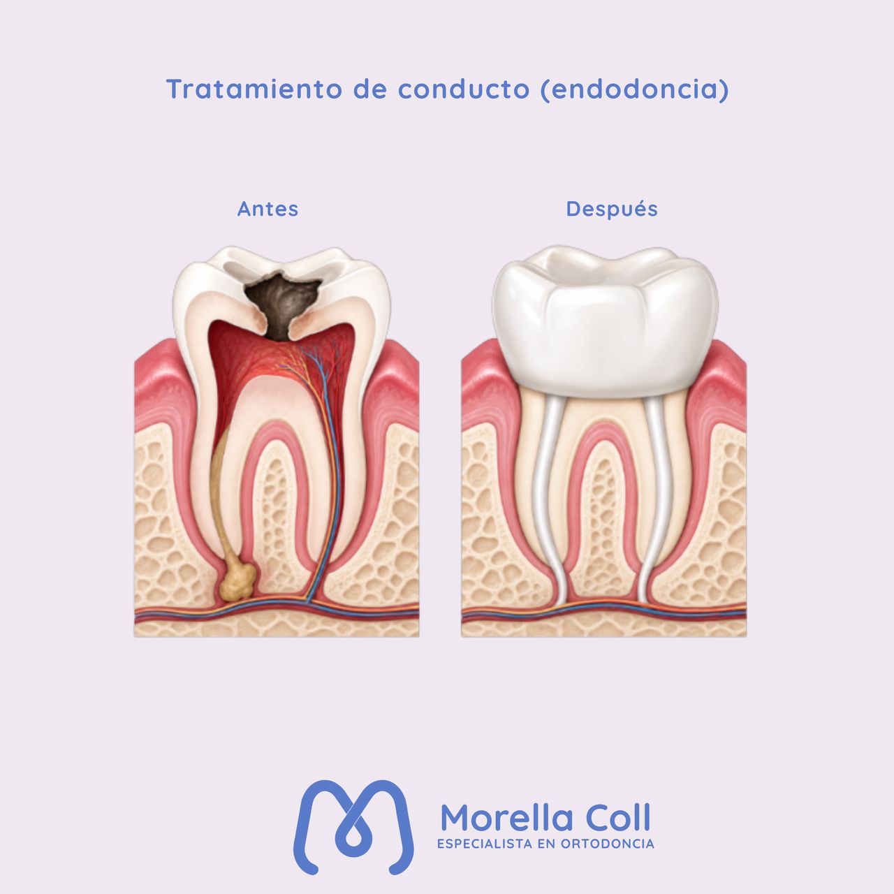 Morella Coll Mibelli-13