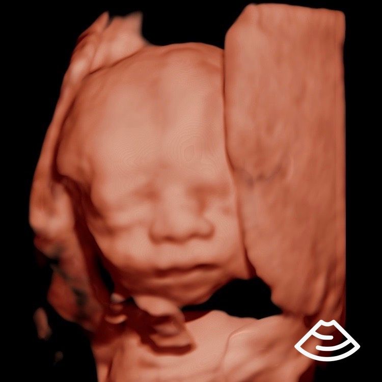 José Luis De La Torre Gastélum-3